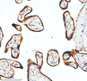 IHC staining of FFPE human placental tissue with STIM1 antibody. HIER: boil tissue sections in pH8 EDTA for 20 min and allow to cool before testing.