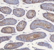 IHC staining of FFPE mouse testis tissue with STIM1 antibody. HIER: boil tissue sections in pH8 EDTA for 20 min and allow to cool before testing.