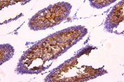 IHC staining of FFPE rat testis tissue with ACACB antibody. HIER: boil tissue sections in pH8 EDTA for 20 min and allow to cool before testing.
