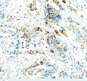 IHC staining of FFPE human appendix tissue with CD24 antibody, HRP-labeled secondary and DAB substrate. HIER: boil tissue sections in pH8 EDTA for 20 min and allow to cool before testing.