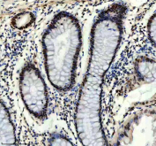 IHC staining of FFPE human colon tissue with Prospero homeobox protein 1 antibody, HRP-secondary and DAB substrate. HIER: boil tissue sections in pH8 EDTA for 20 min and allow to cool before testing.
