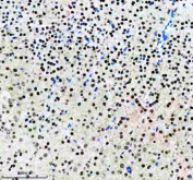 IHC staining of FFPE mouse brain tissue with Alpha-Synuclein antibody, HRP-secondary and DAB substrate. HIER: boil tissue sections in pH8 EDTA for 20 min and allow to cool before testing.