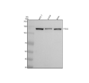 Western blot testing of human 1) MCF7, 2) Jurkat and 3) SiHa cell lysate with POLG antibody. Predicted molecular weight ~140 kDa.