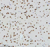 IHC staining of FFPE rat brain tissue with Cyclin dependent kinase 9 antibody, HRP-secondary and DAB substrate. HIER: boil tissue sections in pH8 EDTA for 20 min and allow to cool before testing.