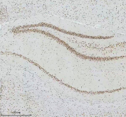 IHC staining of FFPE rat brain tissue with Cyclin dependent kinase 9 antibody, HRP-secondary and DAB substrate. HIER: boil tissue sections in pH8 EDTA for 20 min and allow to cool before testing.