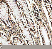 IHC staining of FFPE human colon tissue with SHP2 antibody, HRP-secondary and DAB substrate. HIER: boil tissue sections in pH8 EDTA for 20 min and allow to cool before testing.