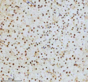 IHC staining of FFPE mouse brain tissue with SHP2 antibody, HRP-secondary and DAB substrate. HIER: boil tissue sections in pH8 EDTA for 20 min and allow to cool before testing.