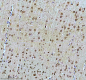 IHC staining of FFPE rat brain tissue with SHP2 antibody, HRP-secondary and DAB substrate. HIER: boil tissue sections in pH8 EDTA for 20 min and allow to cool before testing.