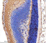 IHC staining of FFPE mouse eye tissue with MYO7A antibody, HRP-secondary and DAB substrate. HIER: boil tissue sections in pH8 EDTA for 20 min and allow to cool before testing.
