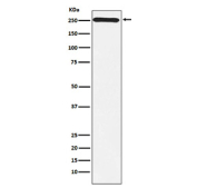 Western blot testing of human Y79 cell lysate with MYO7A antibody. Predicted molecular weight ~254 kDa.