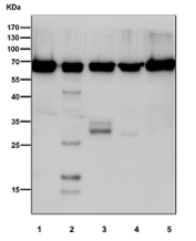 Western blot testing of human 1) HEK293, 2) ThP-1, 3) A431, 4) SH-SY5Y and 5) A673 cell lysate with PDC-E2 antibody. Predicted molecular weight ~69 kDa.