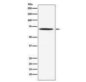 Western blot testing of human Jurkat cell lysate with PDC-E2 antibody. Predicted molecular weight ~69 kDa.