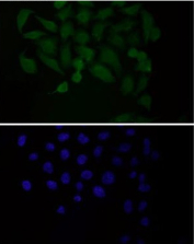 Immunofluorescent staining of FFPE human HeLa cells with PDC-E2 antibody (green) and DAPI nuclear stain (blue). HIER: steam section in pH6 citrate buffer for 20 min.