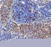 IHC staining of FFPE rat spleen tissue with CXCR5 antibody, HRP-secondary and DAB substrate. HIER: boil tissue sections in pH8 EDTA for 20 min and allow to cool before testing.