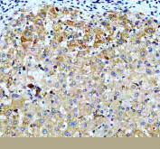 IHC staining of FFPE human liver tissue with VASP antibody, HRP-secondary and DAB substrate. HIER: boil tissue sections in pH8 EDTA for 20 min and allow to cool before testing.
