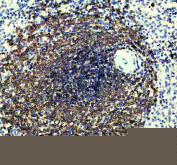 IHC staining of FFPE human spleen tissue with CD22 antibody, HRP-secondary and DAB substrate. HIER: boil tissue sections in pH8 EDTA for 20 min and allow to cool before testing.