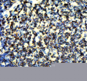 IHC staining of FFPE rat thymus tissue with CD247 antibody, HRP-secondary and DAB substrate. HIER: boil tissue sections in pH8 EDTA for 20 min and allow to cool before testing.