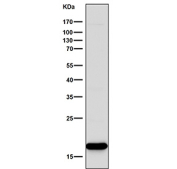 Western blot testing of human Jurkat cell lysate with CD247 antibody. Predicted molecular weight ~19 kDa but may be observed at higher molecular weights due to glycosylation.