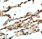 IHC staining of FFPE human lung tissue with FOXF1 antibody, HRP-secondary and DAB substrate. HIER: boil tissue sections in pH8 EDTA for 20 min and allow to cool before testing.