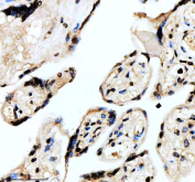 IHC staining of FFPE human placental tissue with FOXF1 antibody, HRP-secondary and DAB substrate. HIER: boil tissue sections in pH8 EDTA for 20 min and allow to cool before testing.