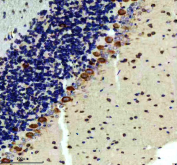 IHC staining of FFPE rat cerebellum tissue with RAPGEF4 antibody, HRP-secondary and DAB substrate. HIER: boil tissue sections in pH8 EDTA for 20 min and allow to cool before testing.
