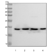 Western blot testing of human 1) HepG2, 2) RT4, 3) U-251 and 4) HEL cell lysate with CIRBP antibody. Predicted molecular weight: 19-28 kDa (multiple isoforms).