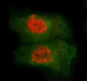 Immunofluorescent staining of FFPE human A549 cells with MED7 antibody (red) and Beta Tubulin mAb (green). HIER: steam section in pH6 citrate buffer for 20 min.