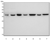 Western blot testing of 1) human HeLa, 2) human A549, 3) human SH-SY5Y, 4) human U-251, 5) rat brain, 6) rat C6 and 7) mouse brain tissue lysate with YWHAZ antibody. Predicted molecular weight ~28 kDa.