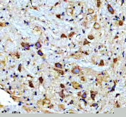 IHC staining of FFPE rat brain tissue with CAMK II alpha antibody, HRP-secondary and DAB substrate. HIER: boil tissue sections in pH8 EDTA for 20 min and allow to cool before testing.
