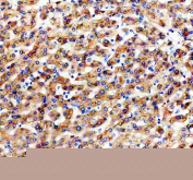IHC staining of FFPE human liver tissue with Apolipoprotein H antibody, HRP-secondary and DAB substrate. HIER: boil tissue sections in pH8 EDTA for 20 min and allow to cool before testing.