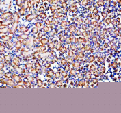 IHC staining of FFPE mouse kidney tissue with GLB1 antibody, HRP-secondary and DAB substrate. HIER: boil tissue sections in pH8 EDTA for 20 min and allow to cool before testing.