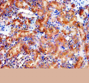 IHC staining of FFPE rat kidney tissue with GLB1 antibody, HRP-secondary and DAB substrate. HIER: boil tissue sections in pH8 EDTA for 20 min and allow to cool before testing.
