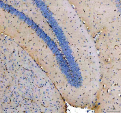 IHC staining of FFPE mouse brain tissue with NES antibody, HRP-secondary and DAB substrate. HIER: boil tissue sections in pH8 EDTA for 20 min and allow to cool before testing.