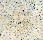 IHC staining of FFPE rat brain tissue with NES antibody, HRP-secondary and DAB substrate. HIER: boil tissue sections in pH8 EDTA for 20 min and allow to cool before testing.