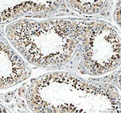IHC staining of FFPE human testis tissue with GPX4 antibody, HRP-secondary and DAB substrate. HIER: boil tissue sections in pH8 EDTA for 20 min and allow to cool before testing.