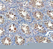 IHC staining of FFPE mouse testis tissue with GPX4 antibody, HRP-secondary and DAB substrate. HIER: boil tissue sections in pH8 EDTA for 20 min and allow to cool before testing.