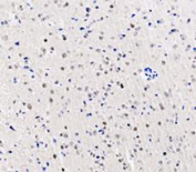 IHC staining of FFPE rat brain tissue with DEAD box protein 1 antibody, HRP-secondary and DAB substrate. HIER: boil tissue sections in pH8 EDTA for 20 min and allow to cool before testing.
