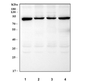 Western blot testing of human 1) K562, 2) Caco-2, 3) SH-SY5Y and 4) RT4 cell lysate with DEAD box protein 1 antibody. Predicted molecular weight ~86 kDa.