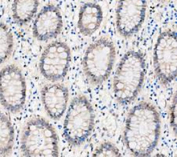 IHC staining of FFPE human colon tissue with DEAD box protein 1 antibody, HRP-secondary and DAB substrate. HIER: boil tissue sections in pH8 EDTA for 20 min and allow to cool before testing.