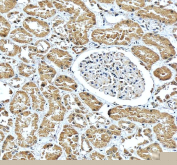 IHC staining of FFPE human kidney tissue with CBS antibody, HRP-secondary and DAB substrate. HIER: boil tissue sections in pH8 EDTA for 20 min and allow to cool before testing.