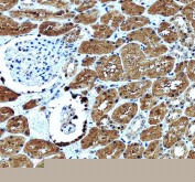 IHC staining of FFPE human kidney tissue with GLRX antibody, HRP-secondary and DAB substrate. HIER: boil tissue sections in pH8 EDTA for 20 min and allow to cool before testing.