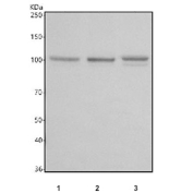 Western blot testing of 1) human Raji, 2) human Ramos and 3) human SH-SY5Y cell lysate with Hexokinase 3 antibody. Predicted molecular weight ~99 kDa.