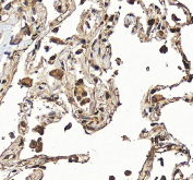 IHC staining of FFPE human liver tissue with Hexokinase 3 antibody, HRP-secondary and DAB substrate. HIER: boil tissue sections in pH8 EDTA for 20 min and allow to cool before testing.