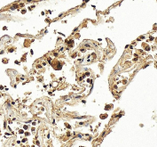IHC staining of FFPE human liver tissue with Hexokinase 3 antibody, HRP-secondary and DAB substrate. HIER: boil tissue sections in pH8 EDTA for 20 min and allow to cool before testing.