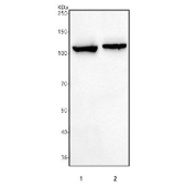 Western blot testing of 1) rat C6 and 2) mouse NIH 3T3 cell lysate with Hephaestin antibody. Predicted molecular weight ~130 kDa.