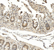 IHC staining of FFPE human small intestine tissue with Hephaestin antibody, HRP-secondary and DAB substrate. HIER: boil tissue sections in pH8 EDTA for 20 min and allow to cool before testing.