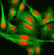 Immunofluorescent staining of FFPE human U-2 OS cells with SPRED2 antibody (red) and Alpha Tubulin mAb (green). HIER: steam section in pH6 citrate buffer for 20 min.