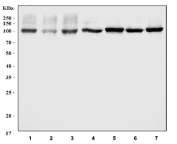 Western blot testing of 1) human A549, 2) human U-2 OS, 3) human MDA-MB-453, 4) human MCF7, 5) rat brain, 6) rat testis and 7) mouse brain tissue lysate with USP5 antibody. Predicted molecular weight ~96 kDa.