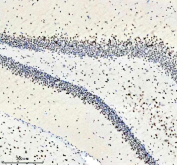 IHC staining of FFPE rat brain tissue with PABPN1 antibody, HRP-secondary and DAB substrate. HIER: boil tissue sections in pH8 EDTA for 20 min and allow to cool before testing.