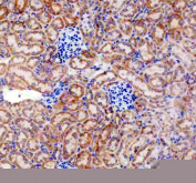 IHC staining of FFPE mouse kidney tissue with TRAIL-R4 antibody, HRP-secondary and DAB substrate. HIER: boil tissue sections in pH8 EDTA for 20 min and allow to cool before testing.